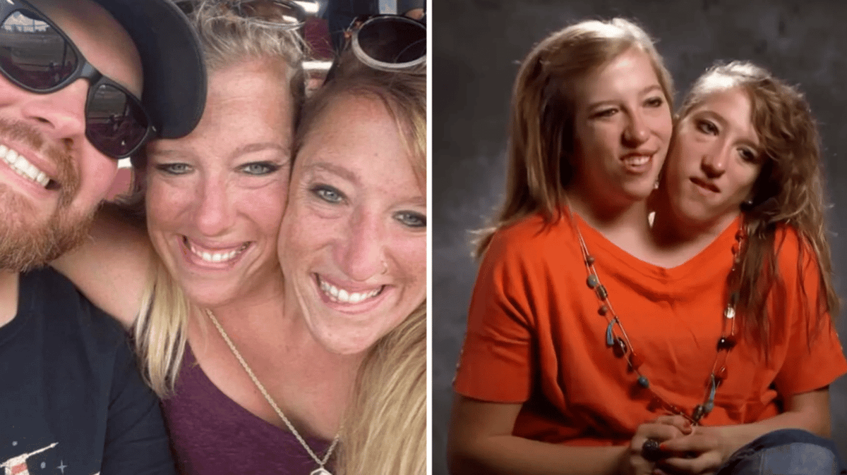 Conjoined twins Abby and Brittany Hensel would make history if one of