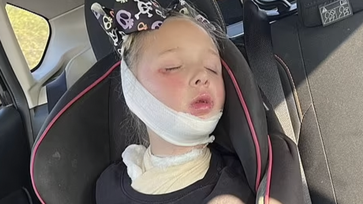 Parents issue serious warning over microwave mistake after girl, 7, gets put in coma with horrific injuries