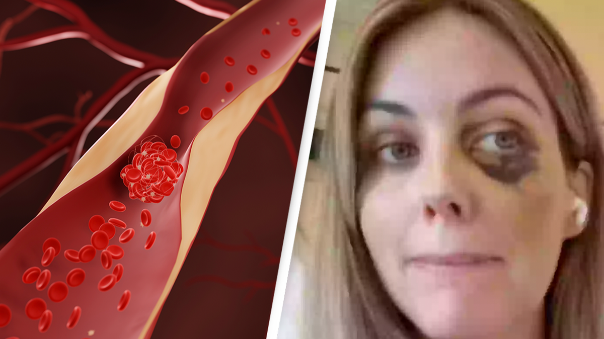 How to prevent blood clots on long-haul flights after woman almost dies during plane journey