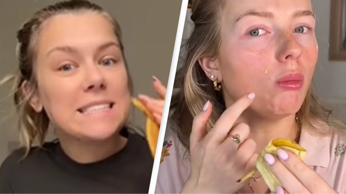 Expert warns new Gen Z trend using bananas as 'natural botox' may actually be dangerous