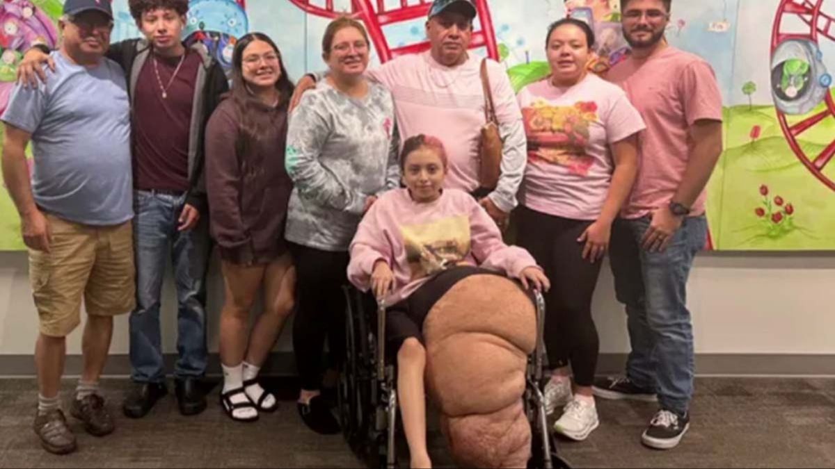 Florida teen undergoes 17-hour surgery to amputate 170-pound leg that ...
