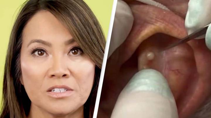 Politisk velordnet Postimpressionisme Dr Pimple Popper banned from making money off her 'too graphic' videos on  YouTube