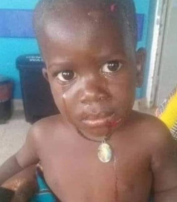 两岁的保罗·伊加（Paul Iga）几乎被河马吞没了，但幸运的是幸存下来。信用：Twitter