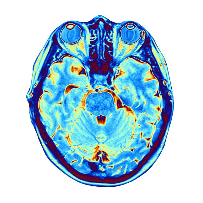 该研究揭示了有史以来第一次记录垂死的大脑。学分：科学图书馆/阿拉米库存照片