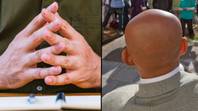 科学家说，男人可以看手指检查他们最终秃头的可能性。“loading=