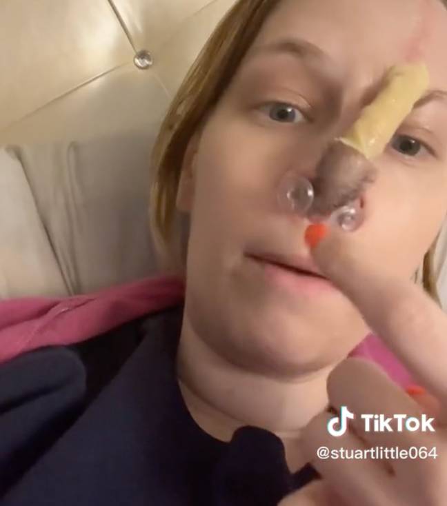 凯利（Kelly）详细介绍了医务人员如何修复她的鼻子。学分： @stuartlittle064/tiktok