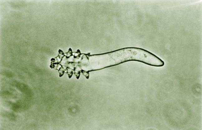 Demodex Folliculorum螨虫生活在人类的毛孔中，在睡前玩耍。学分：科学历史图像/Alamy Stock Photo