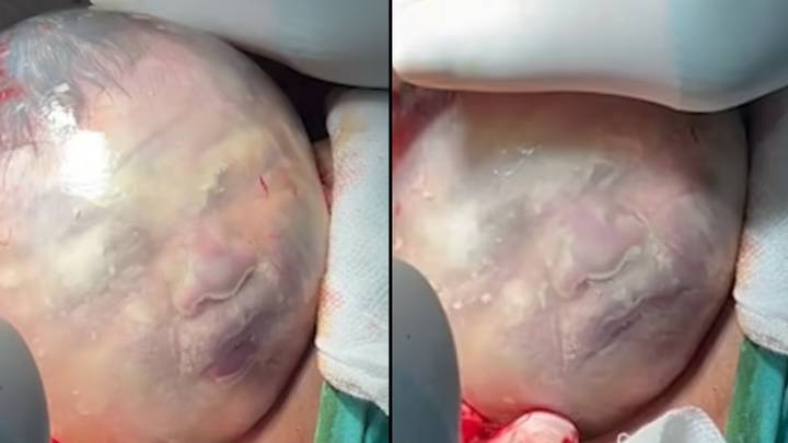 迷人的镜头显示婴儿的脸在羊膜囊中移动
