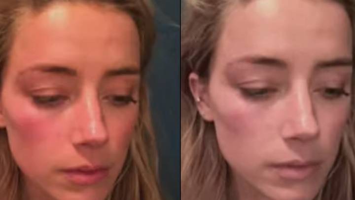 Amber听到的被指控编辑照片，这些照片显示了约翰尼·德普（Johnny Depp）的虐待