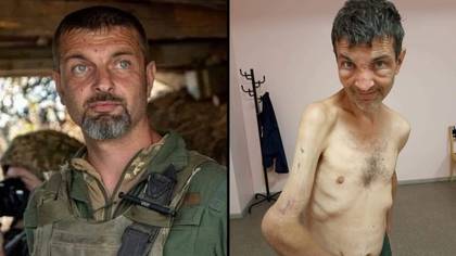 乌克兰战俘表明他的身体令人震惊