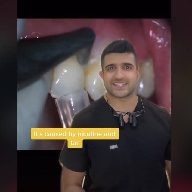 牙医展示了如何清洁牙齿。图片来源：@Thelondondentist / tiktok