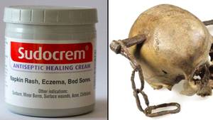 Sudocrem被迫回应索赔奶油固定刺激的头骨