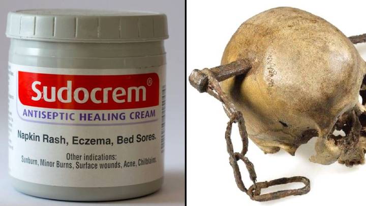 Sudocrem被迫回应索赔奶油固定刺激的头骨