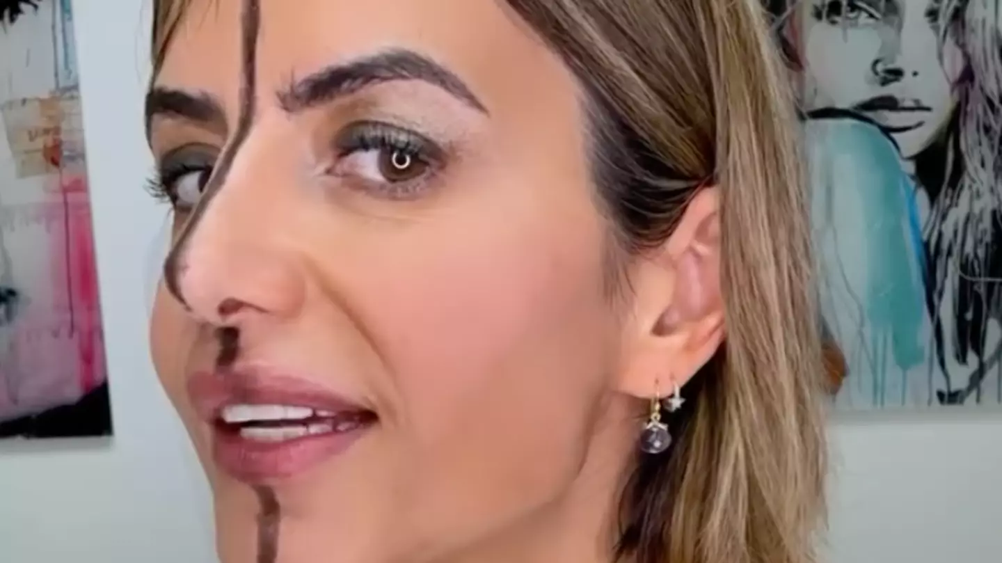 Doctor injects Botox into one side of her face and reveals shocking effects