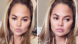 Chrissy Teigen Admits To Having Fat Removed From Her Face