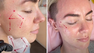 People Are Getting Zodiac Constellations Tattooed As Freckles