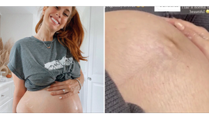 Stacey Solomon Praised As She Hits Back At Troll For Comments On Her Hairy Baby Bump
