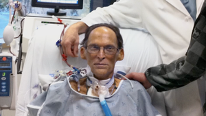 World's First Heartless Human Was Able To Live Without A Pulse