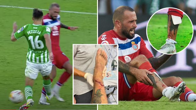 Espanyol's Aleix Vidal Left With Bloodied Bone Poking Out Of Leg After Wearing Cardboard Shinpads