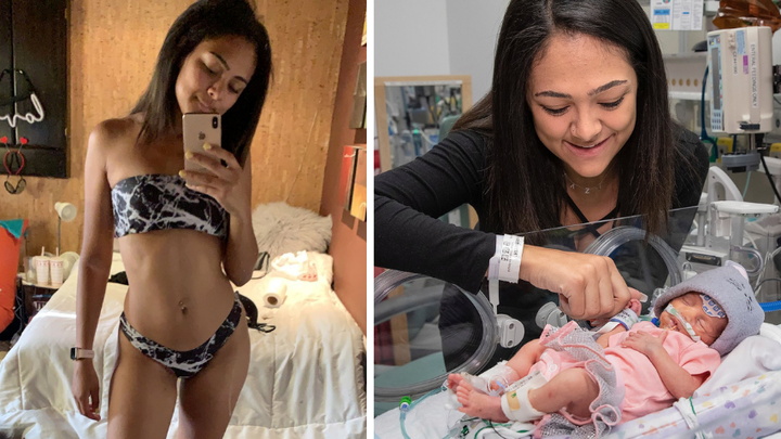 Woman Who Felt 'Bloated' After Sandwich Shocked To Discover She's 5 Months Pregnant
