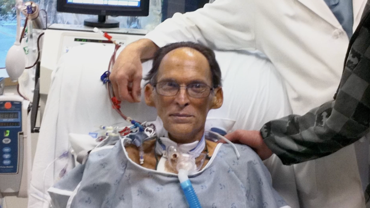 World&#39;s First Heartless Human Was Able To Live Without A Pulse