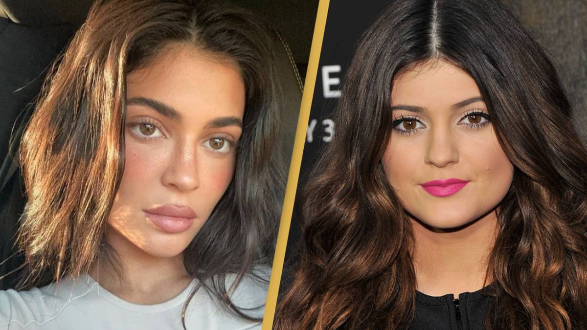 Kylie Jenner explains why she looks so different in before and after photos