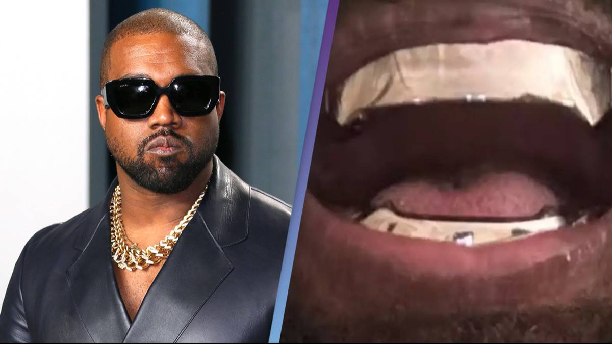 Kanye West's titanium teeth leave people wondering how he'll clean them