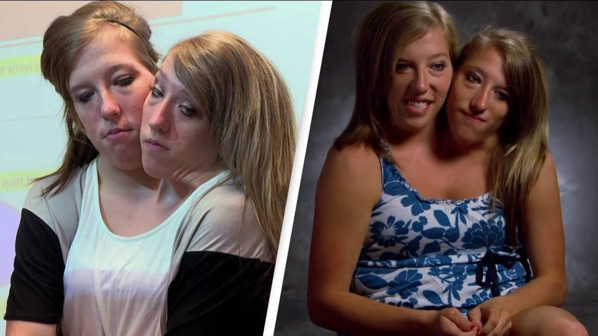Conjoined twins Abby and Brittany Hensel explain how they drive a car