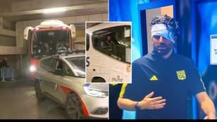 BREAKING: Lyon bus 'attacked' ahead of Marseille game with manager Fabio Grosso 'injured'