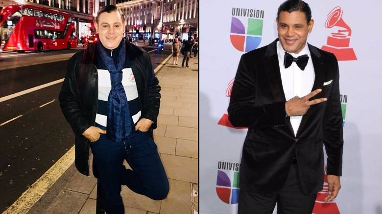 From Black to White: Why Sammy Sosa and Others Are Bleaching Their Skin