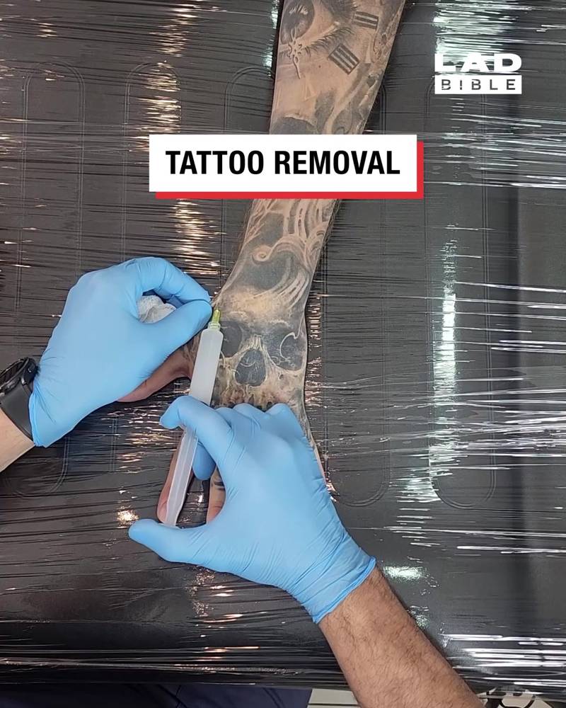 How to remove skull hand tattoo