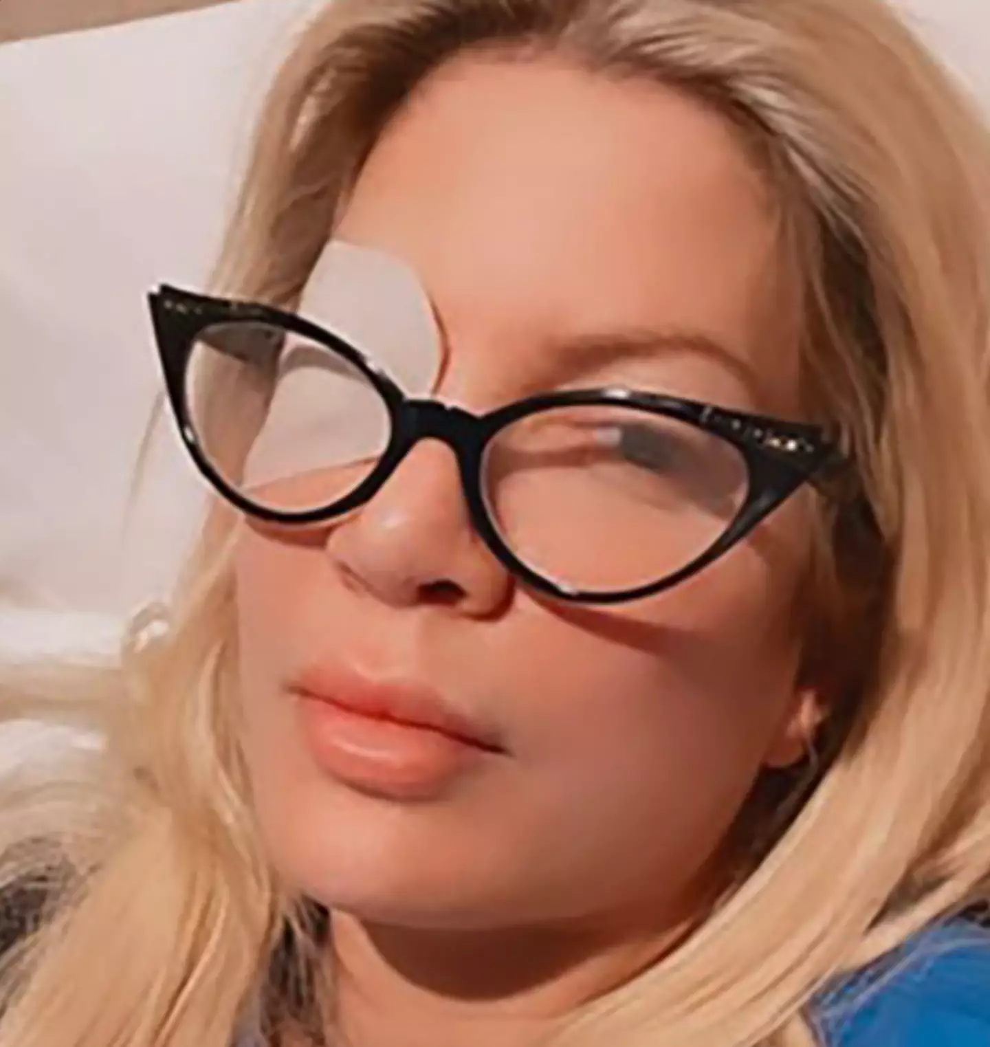 Tori Spelling has been wearing an eye patch since the ulcer appeared.