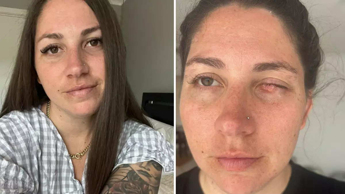 Mum, 28, ends up having eye sewn shut after lash appointment revealed devastating diagnosis