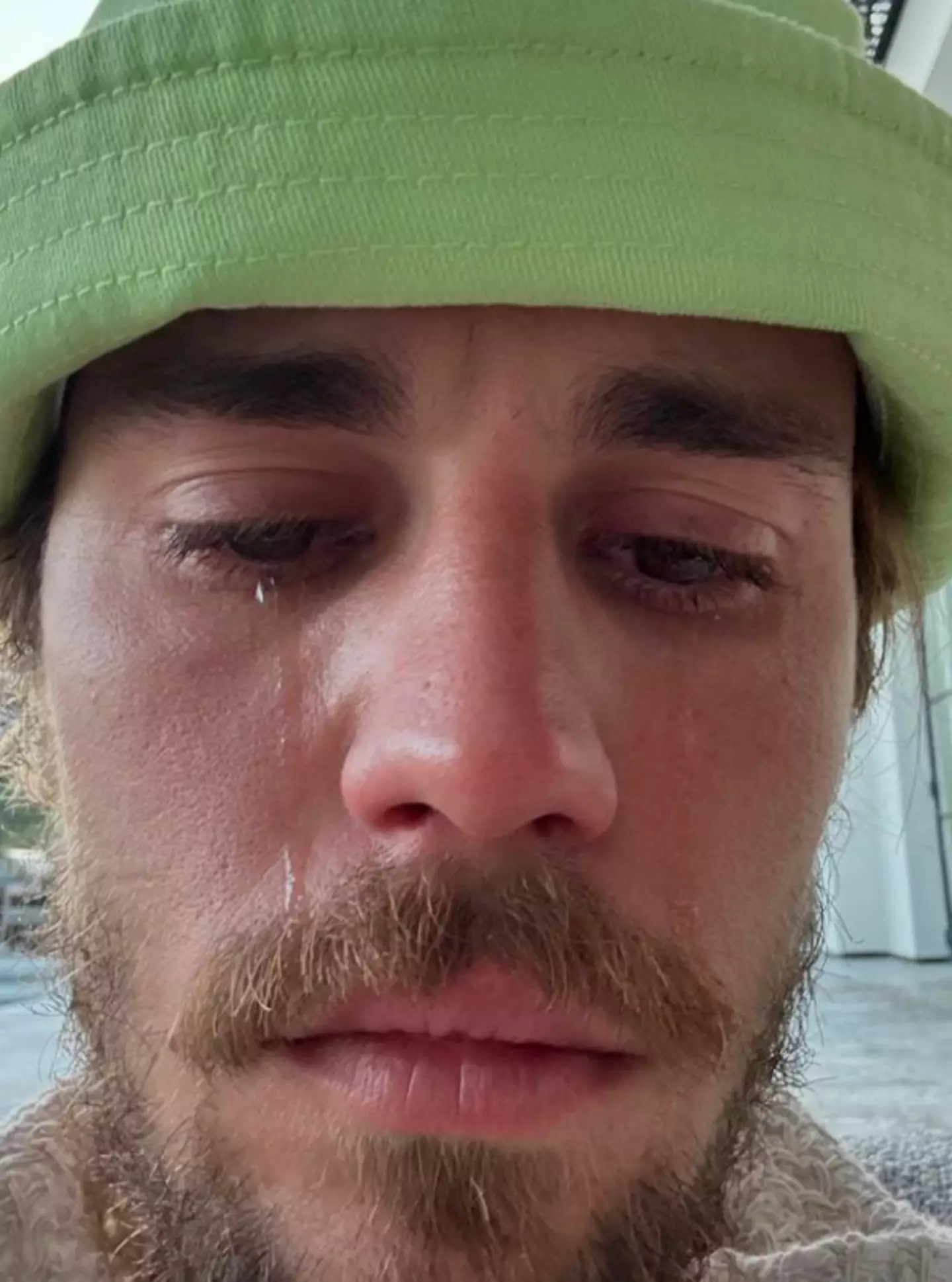 The crying selfie shocked and worried fans the other week. Instagram/ @justinbieber