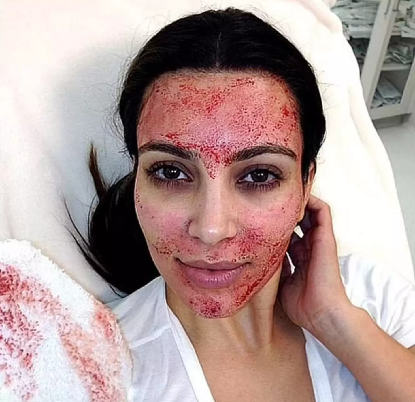 Celebrities such as Kim Kardashian are fans of 'vampire facials,' which use plasma from your own blood to promote collagen production. (Instagram/@kimkardashian)