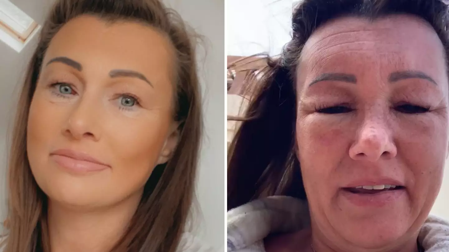 Mum says she 'could’ve died' after nasal tanning spray dubbed 'Barbie drug' 'poisoned' her body