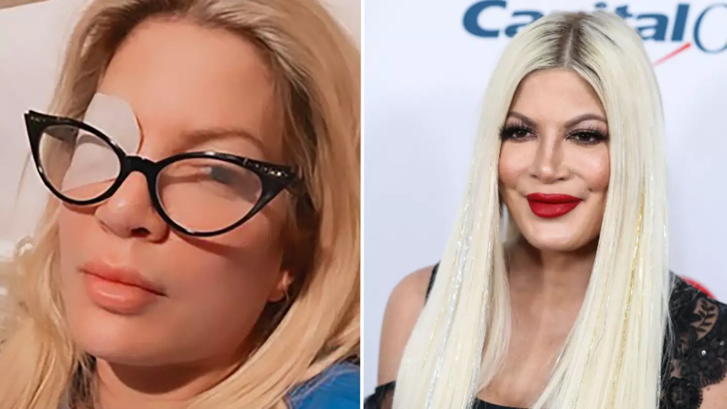 Tori Spelling risked going blind after sleeping in contact lenses for 20 days