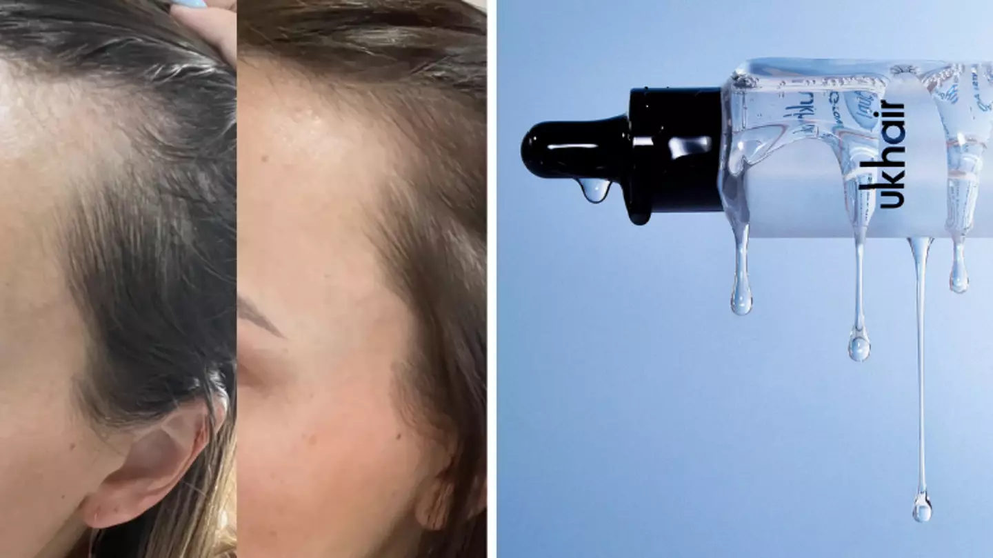 Women rave about serum that promises to fix thinning hair in 'weeks'