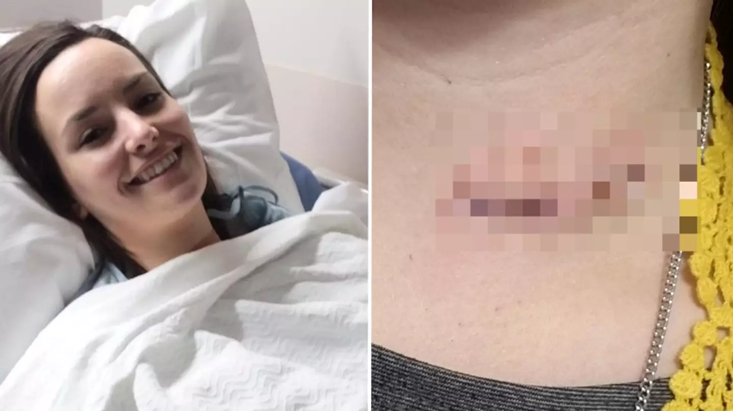 Woman claims BBQ almost killed her as wire bristle ‘skewers’ her throat after swallowing it