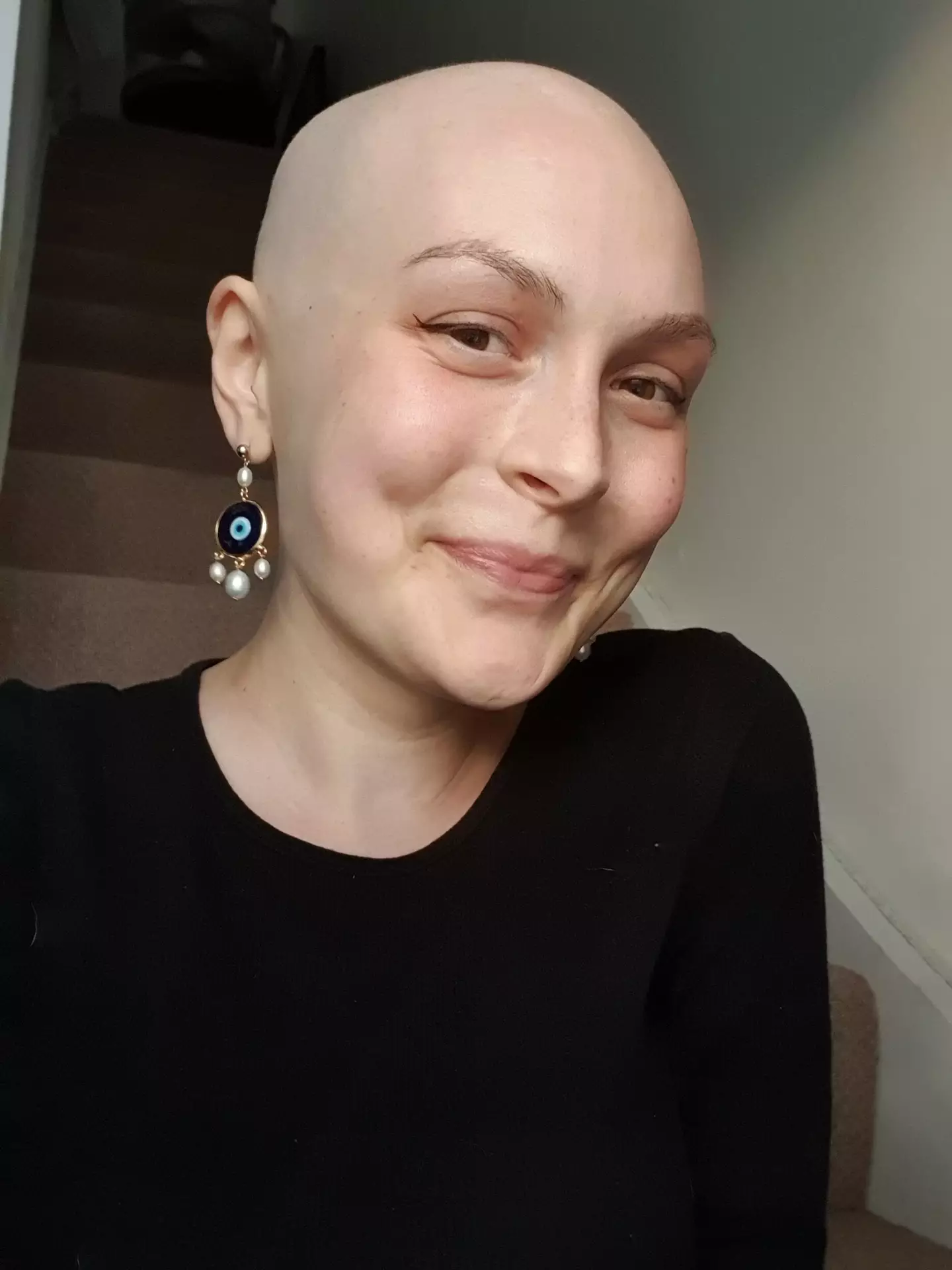 Chloe started chemotherapy as soon as she was diagnosed.
