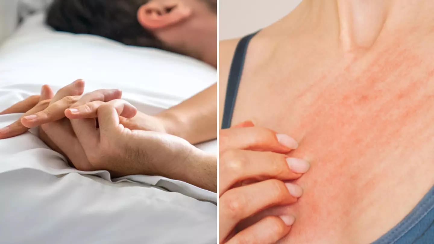 Urgent warning issued to daters after scabies outbreak