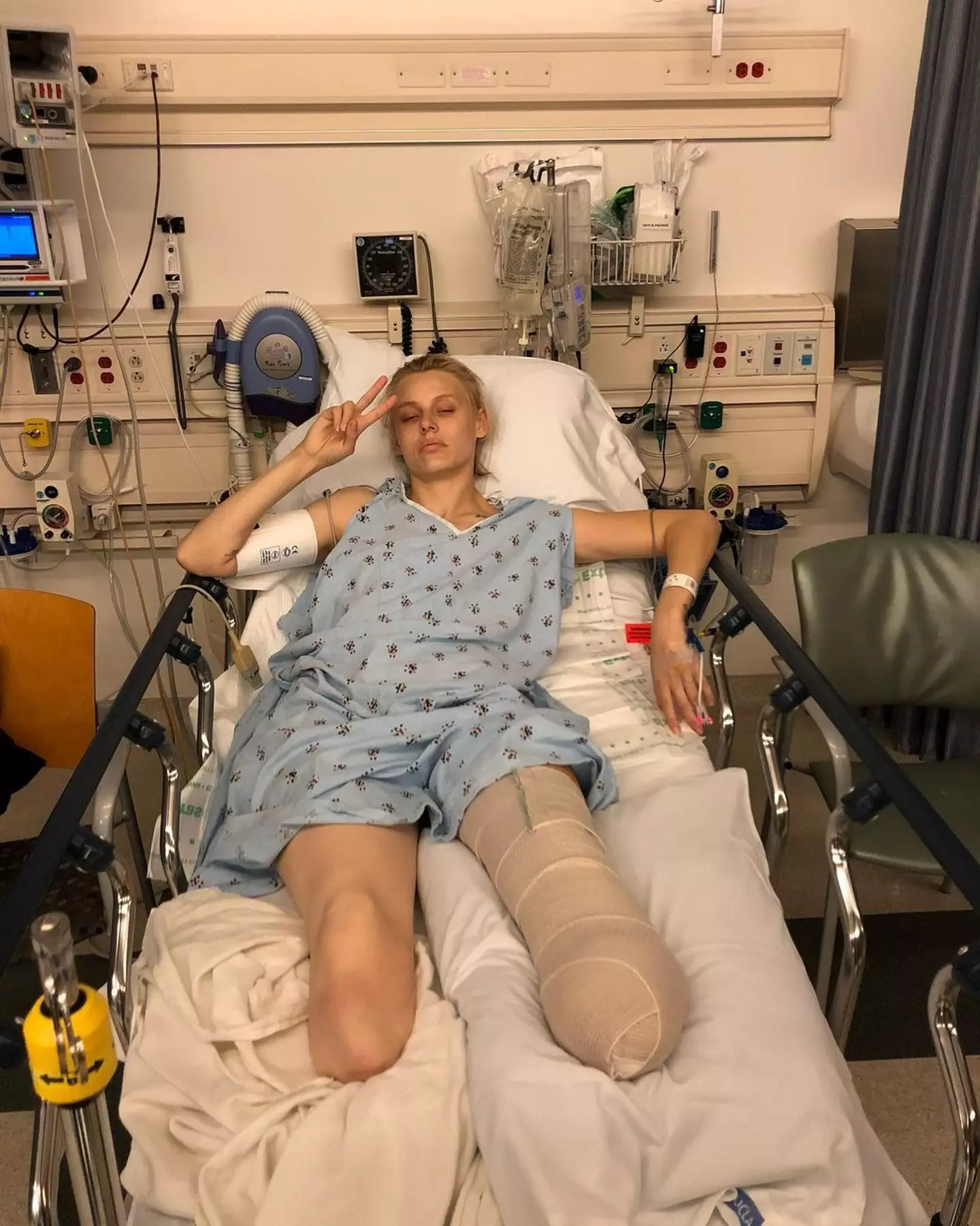 Lauren opted to have her left leg amputated after losing her right. (Instagram/@theimpossiblemuse)