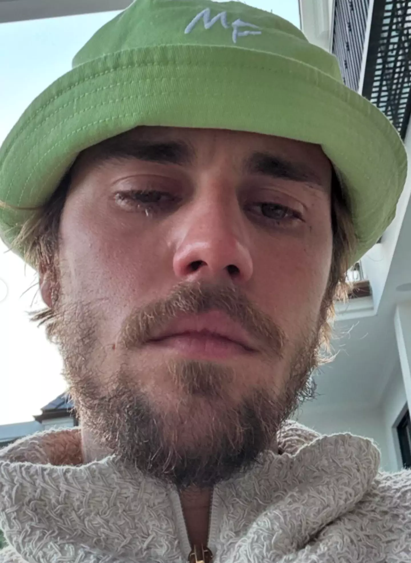 Justin shared several snaps of himself in tears. (Instagram/@justinbieber)