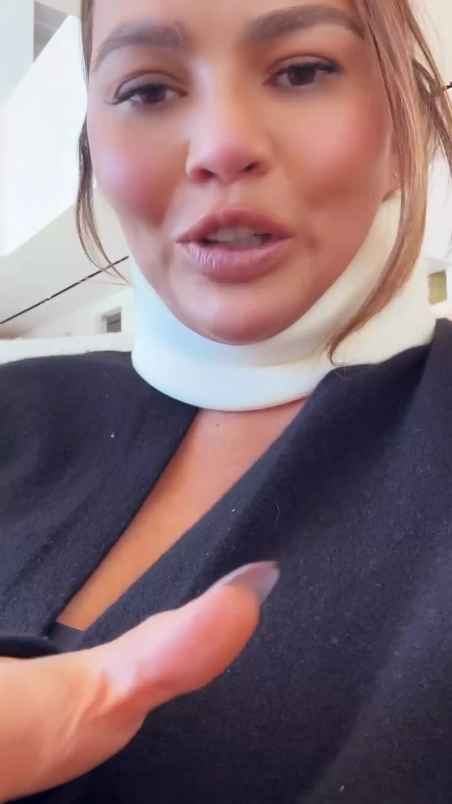 Chrissy posted pictures of herself wearing a neck brace. Instagram/chrissyteigen