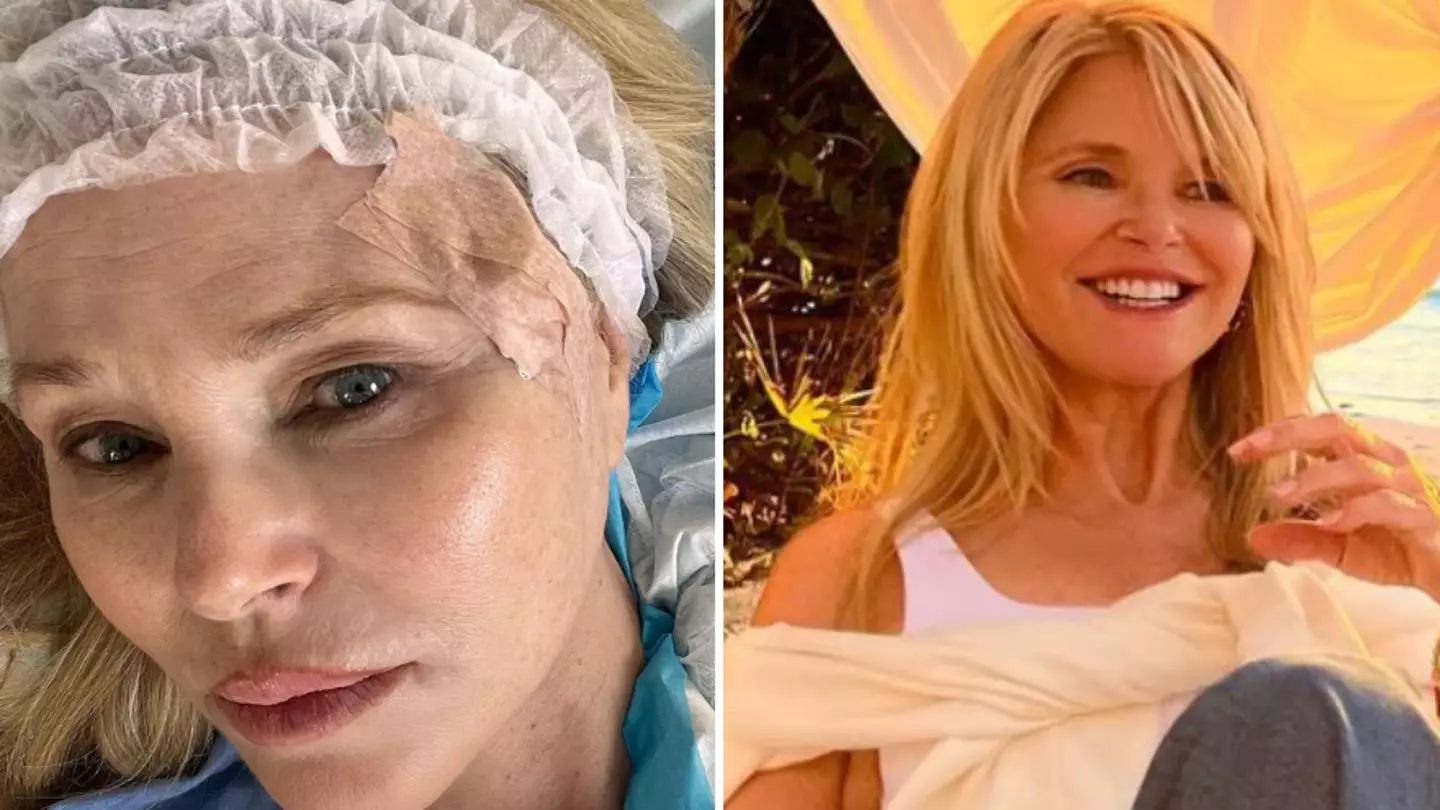Supermodel Christie Brinkley reveals cancer diagnosis as she gives frank warning to fans
