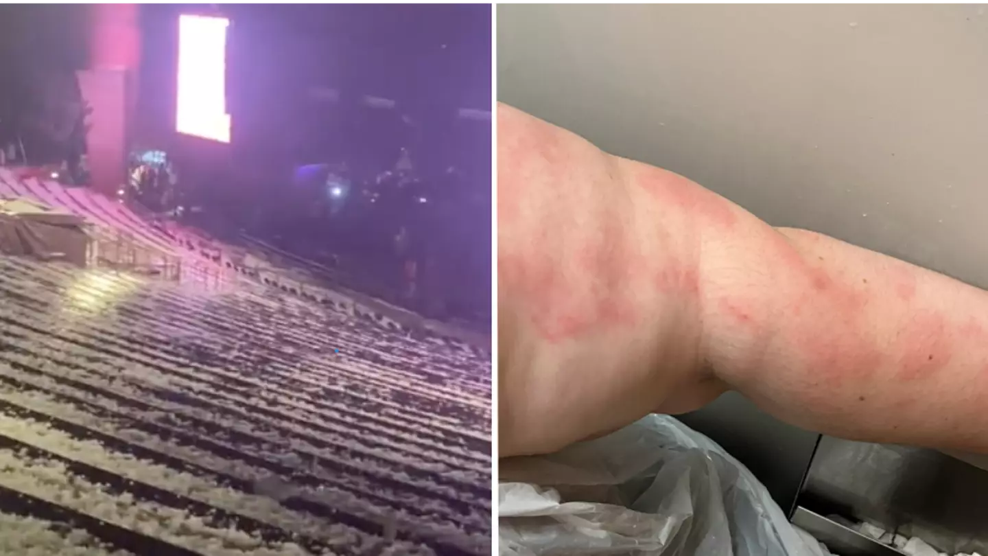 Louis Tomlinson fans forced to flee 'traumatic' concert as hailstones leave several hospitalised