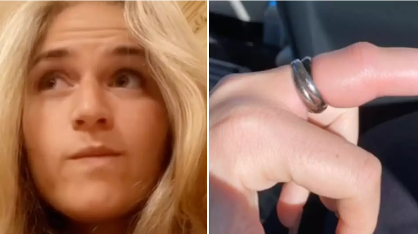 Woman shares terrifying warning over sleeping in rings