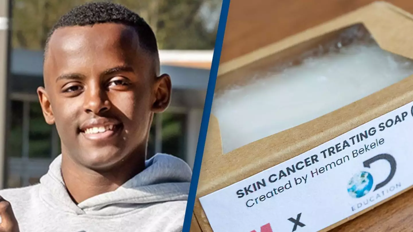 14-year-old named America's Top Young Scientist for development of skin  cancer treatment