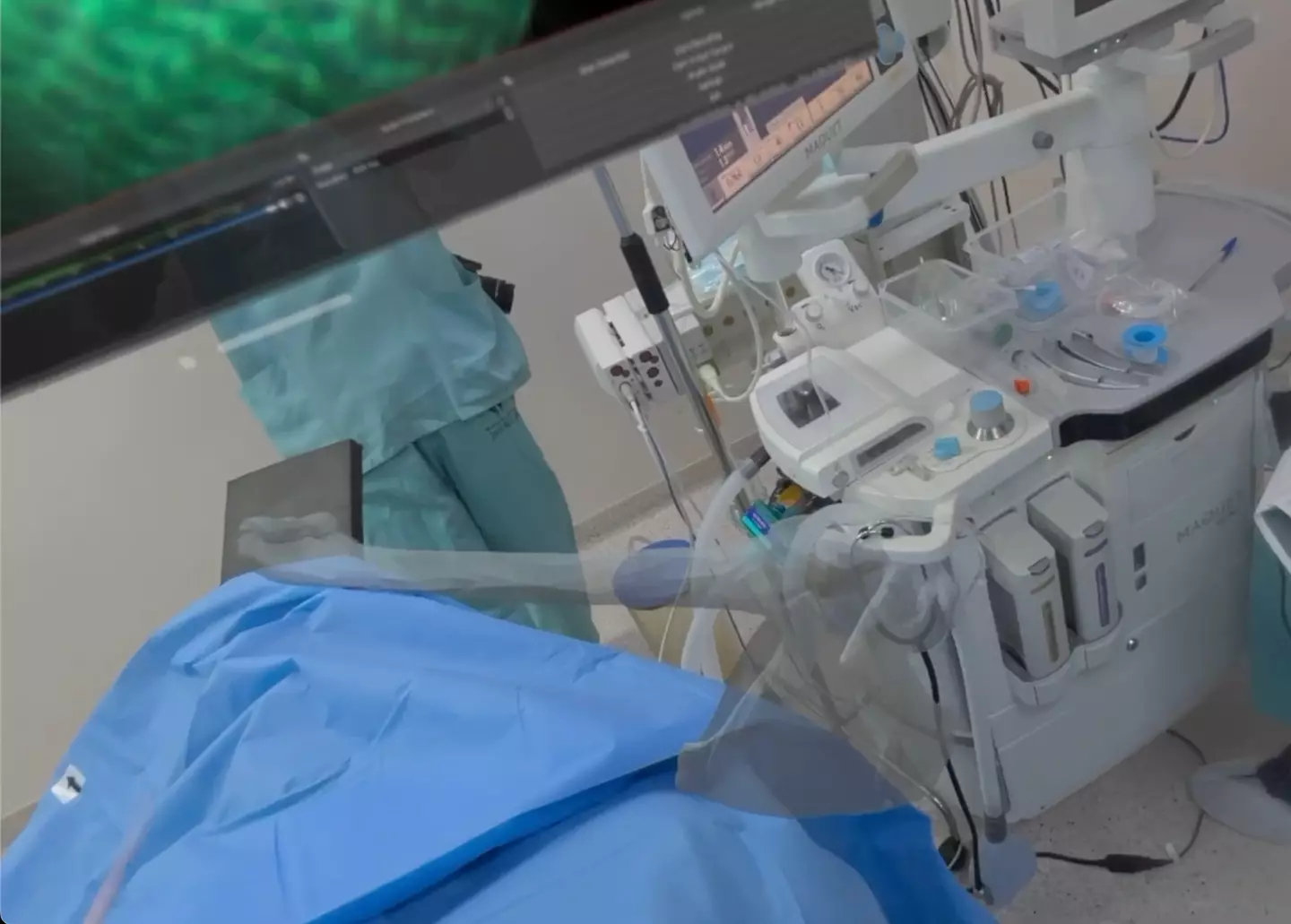 The surgery showed how the device could assist with surgery. (YouTube / ombroecotovelo)