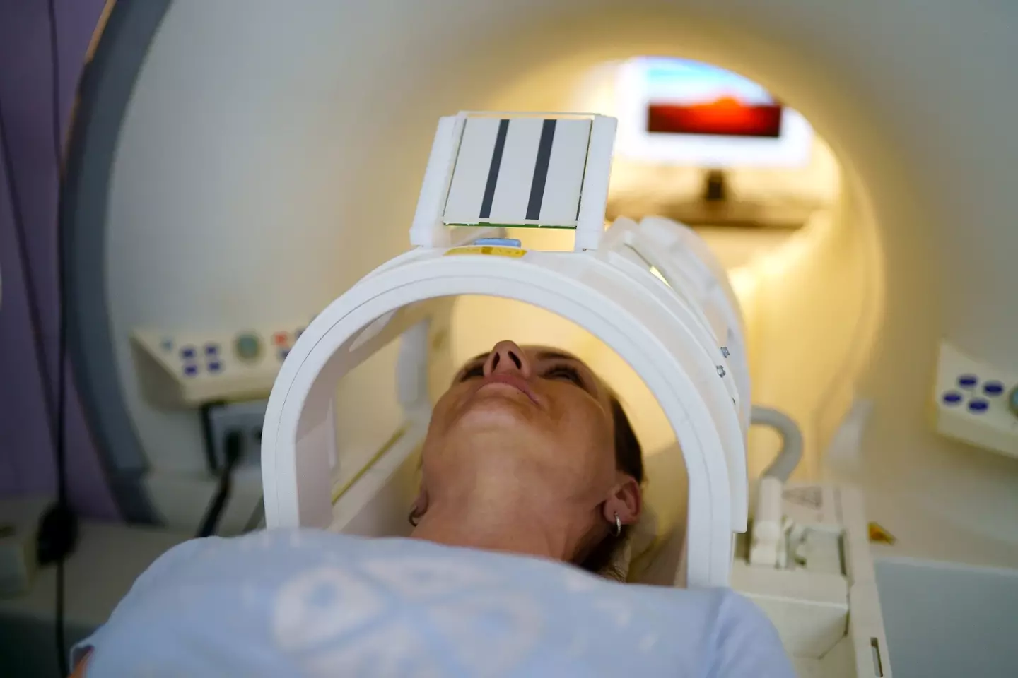 MRI scans showed 'dramatic' findings. (Getty Stock Images/ Sebastian Condrea) 